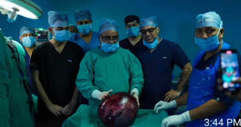 श्री महंत इन्दिरेश अस्पताल में सर्जिकल मास्टरस्ट्रोक पेट से निकाली 13 किलो की गांठ